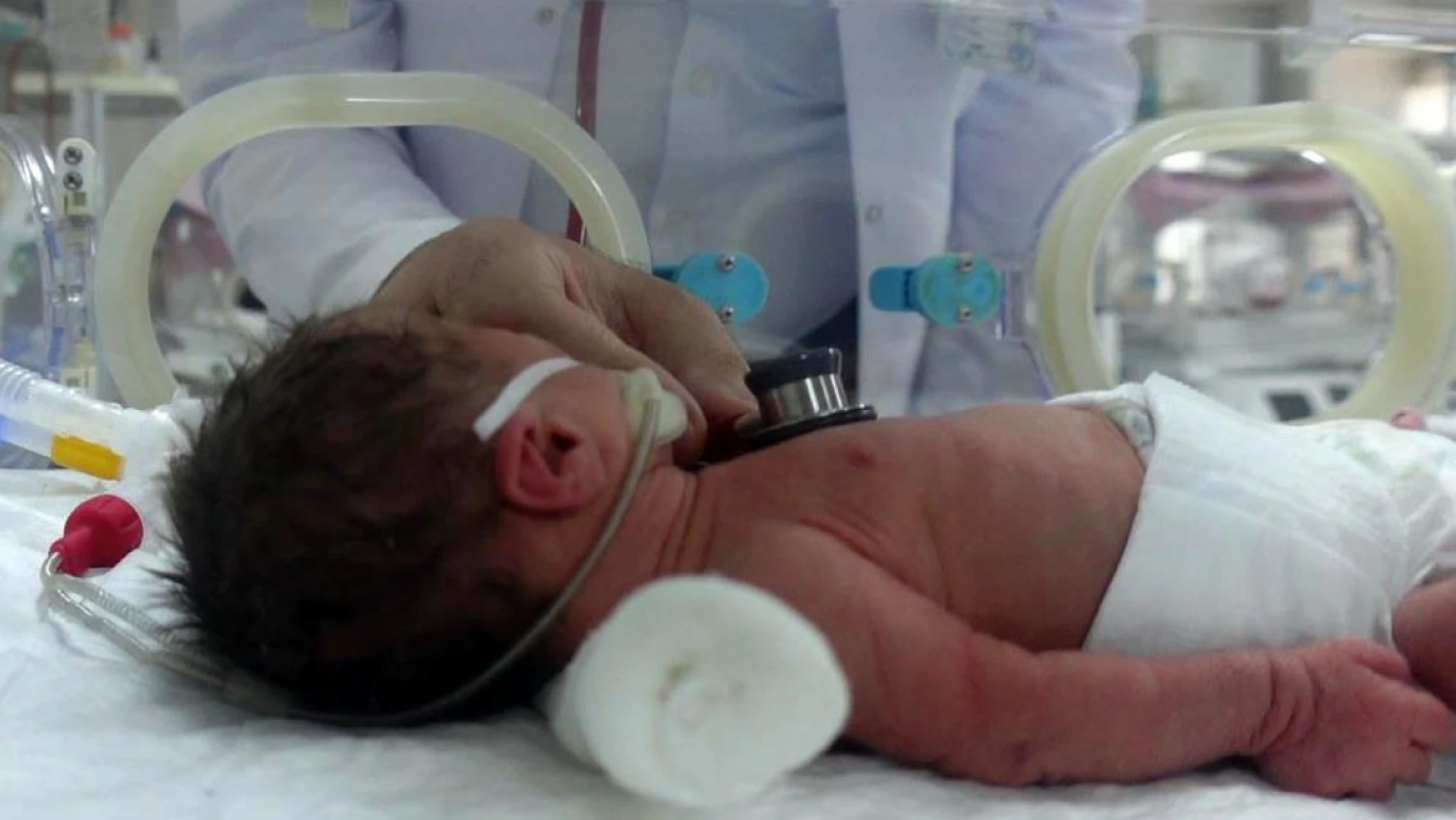 Prematüre Bebeklerde Yaşam Şansı: Prof. Dr. Mustafa Aydın'ın Perspektifi