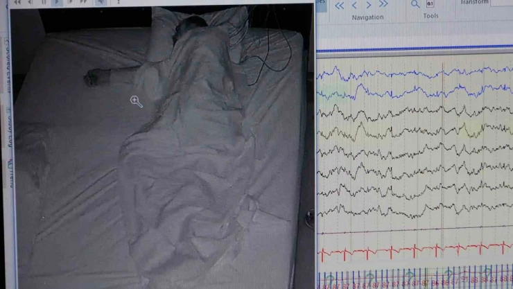 Klinik Nörofizyoloji Uzmanı Leba: 'Uyku hastalığı kişinin ömrünü kısaltır'